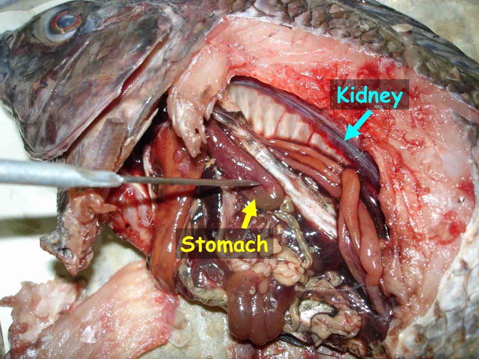 Kidney Stomach