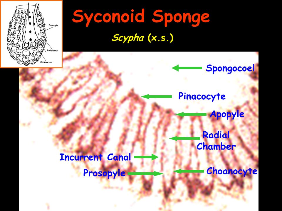 Syconoid Sponge Scypha (x.s.) Spongocoel Pinacocyte Apopyle