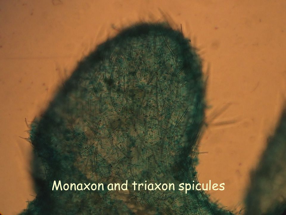 Monaxon and triaxon spicules