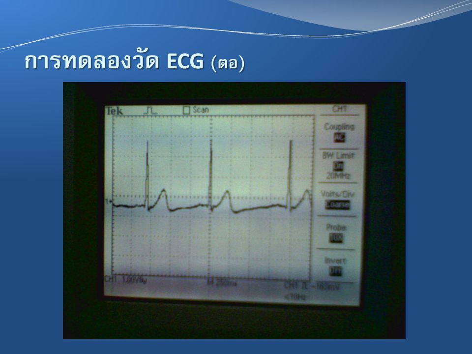 การทดลองวัด ECG (ต่อ)