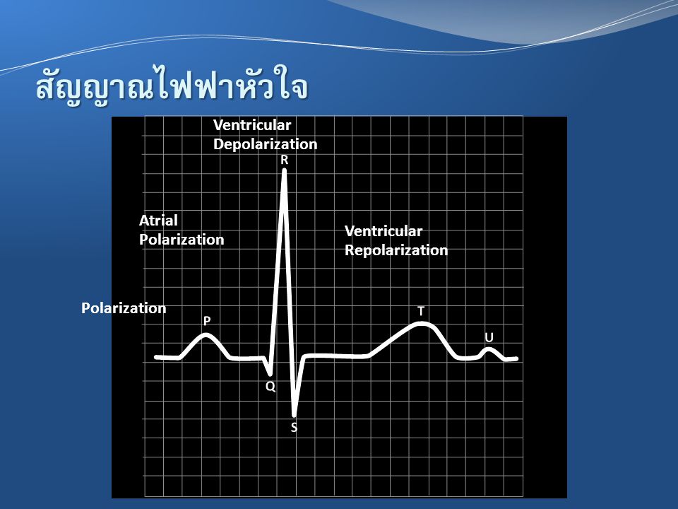 สัญญาณไฟฟ้าหัวใจ Ventricular Depolarization Atrial Polarization