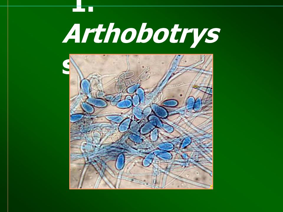 1. Arthobotrys sp.