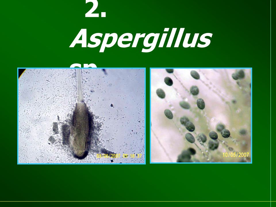 2. Aspergillus sp.