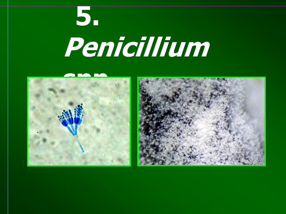 5. Penicillium spp.
