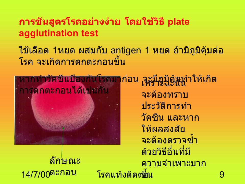 การชันสูตรโรคอย่างง่าย โดยใช้วิธี plate agglutination test