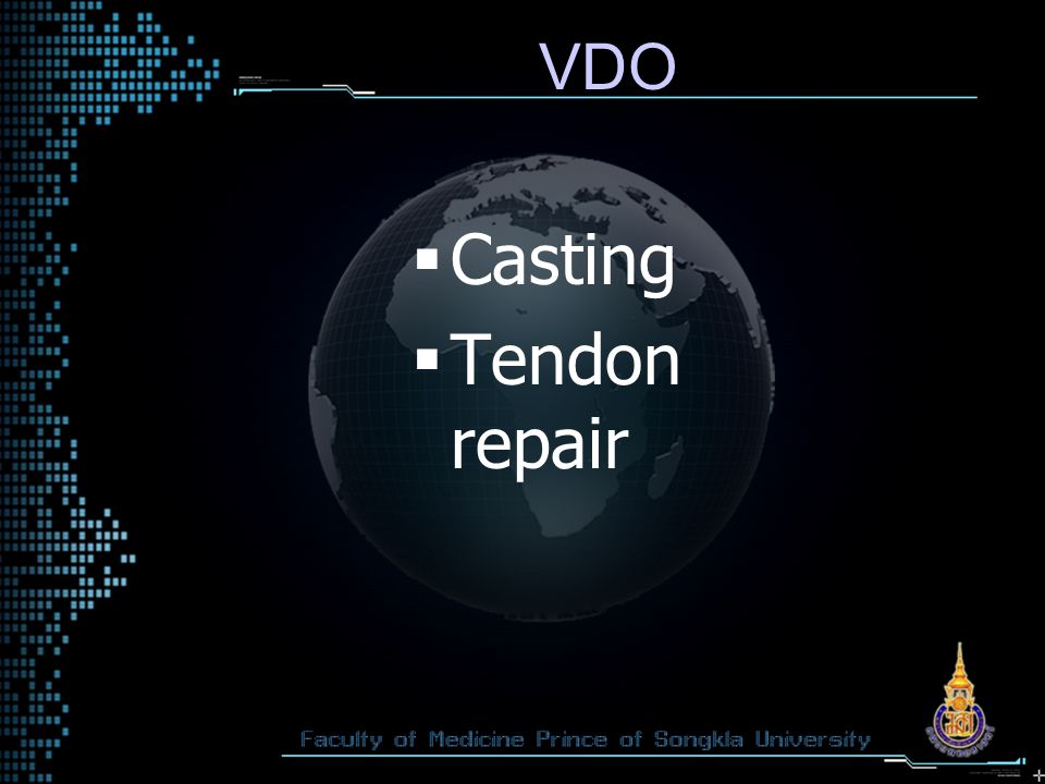 VDO Casting Tendon repair