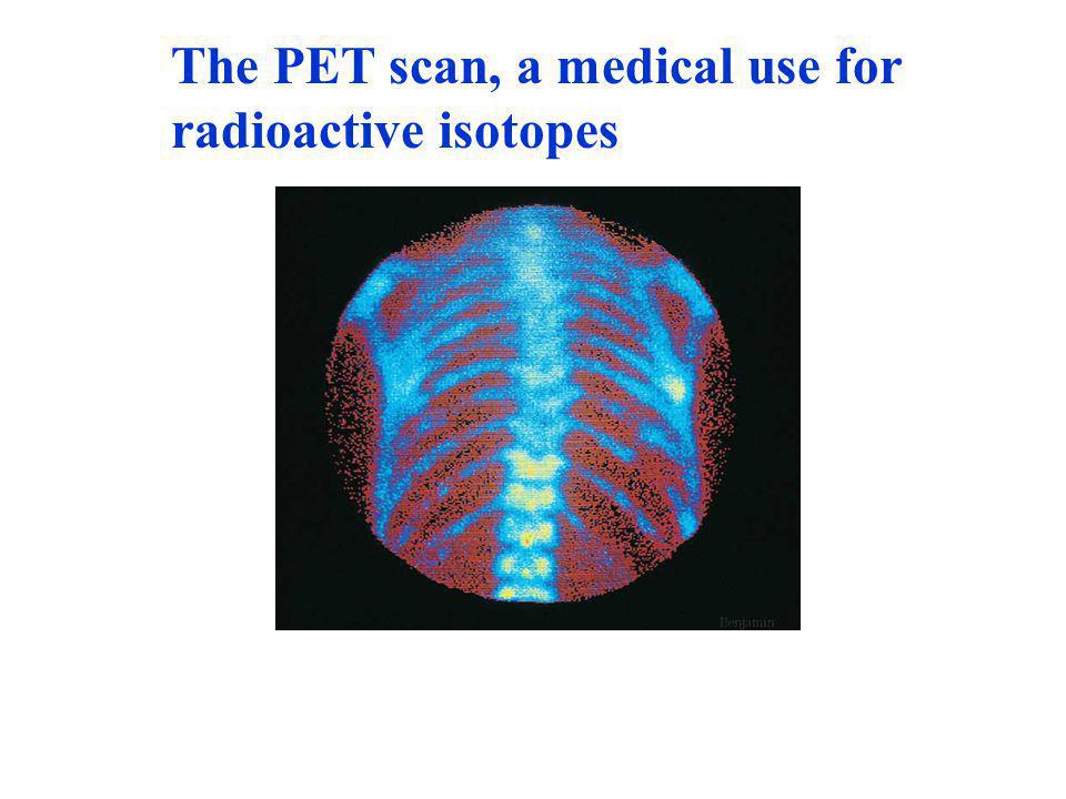 The PET scan, a medical use for radioactive isotopes