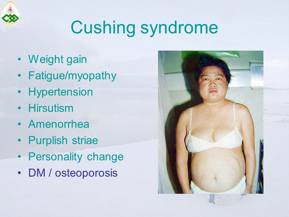 Cushing syndrome Weight gain Fatigue/myopathy Hypertension Hirsutism