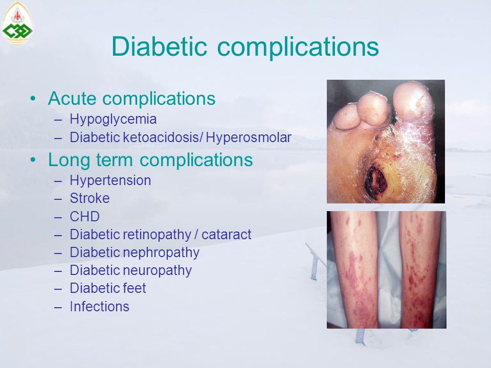 Diabetic complications