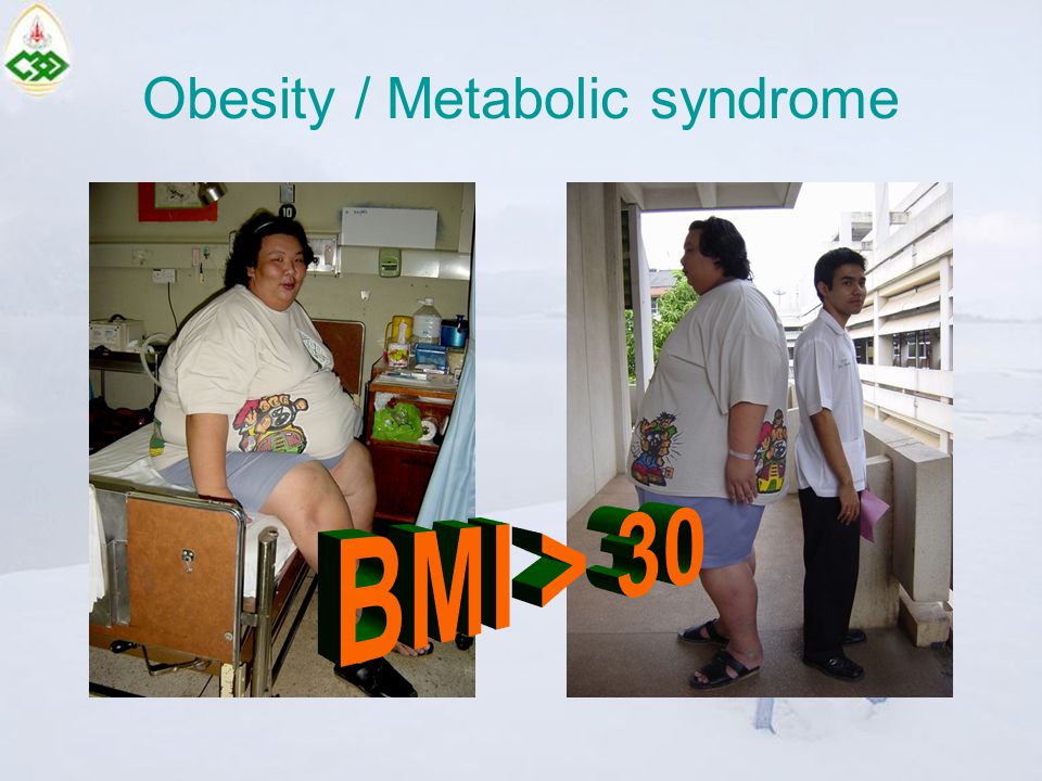 Obesity / Metabolic syndrome
