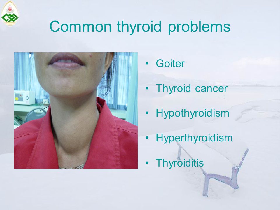 Common thyroid problems