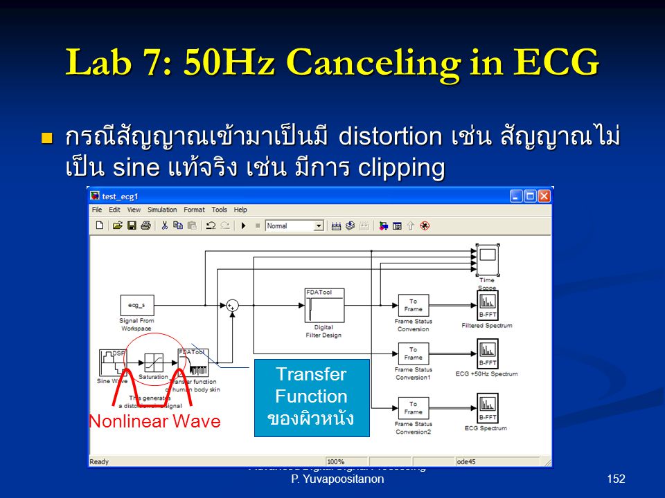 Lab 7: 50Hz Canceling in ECG