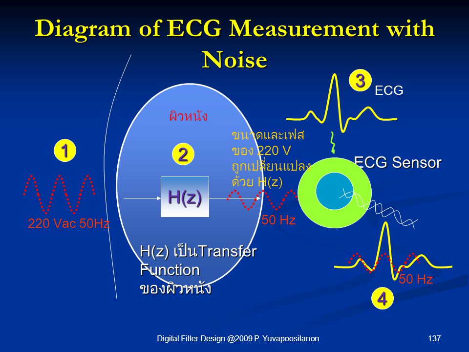 Diagram of ECG Measurement with Noise