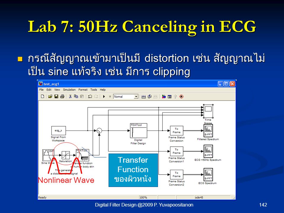 Lab 7: 50Hz Canceling in ECG