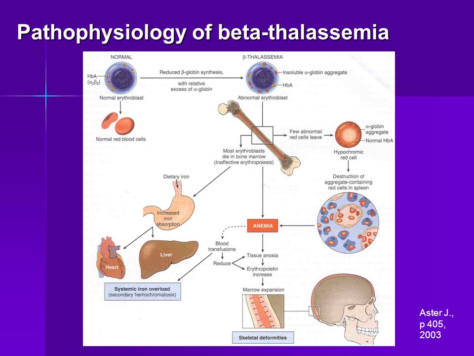 Pathophysiology of beta-thalassemia