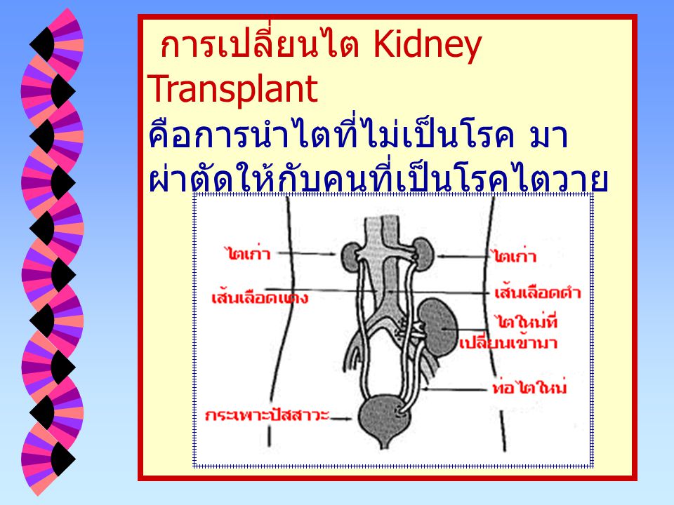 การเปลี่ยนไต Kidney Transplant