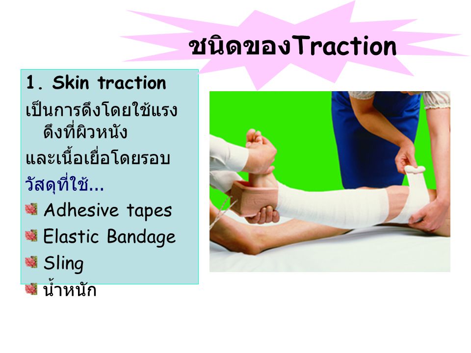 ชนิดของTraction 1. Skin traction เป็นการดึงโดยใช้แรงดึงที่ผิวหนัง