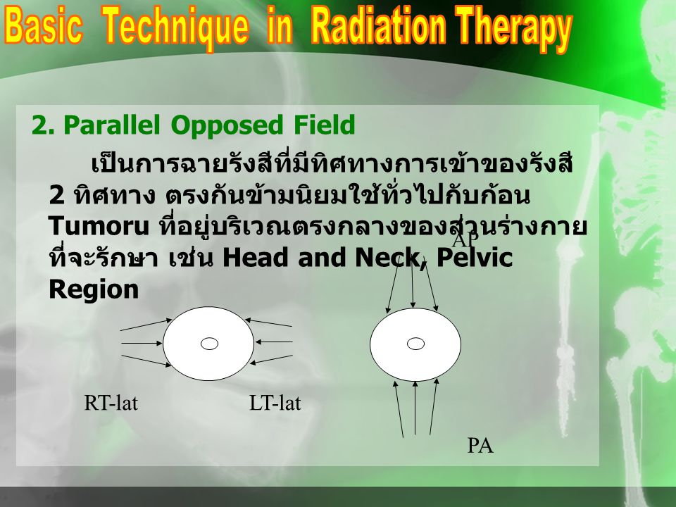 Basic Technique in Radiation Therapy