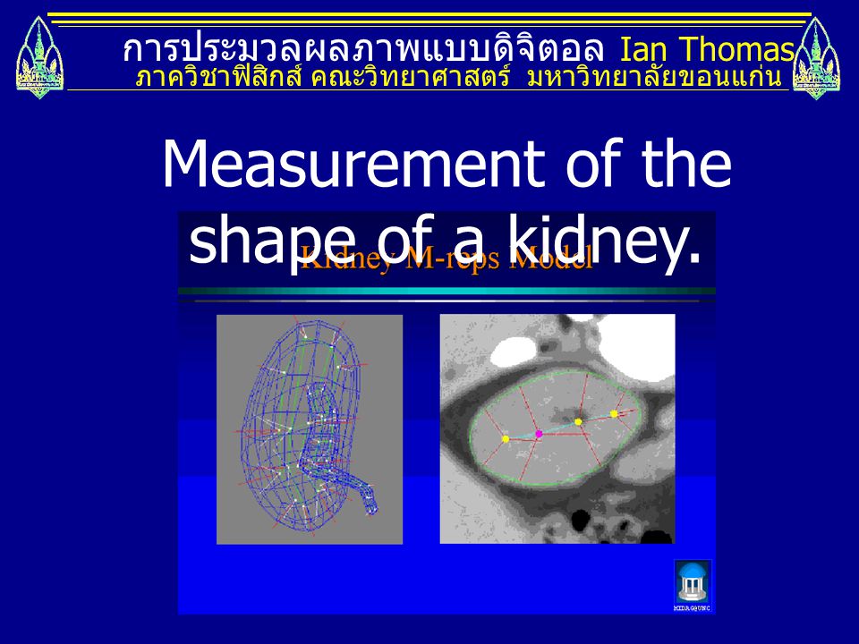 Measurement of the shape of a kidney.