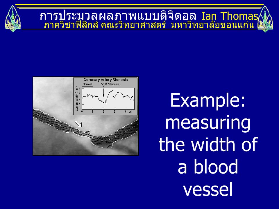 Example: measuring the width of a blood vessel