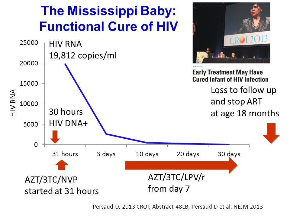 The Mississippi Baby: Functional Cure of HIV