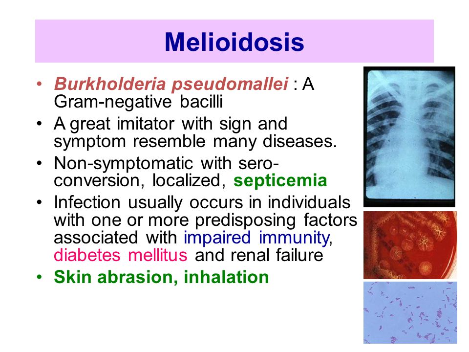 Melioidosis Research Center (MRC), - Ppt ดาวน์โหลด