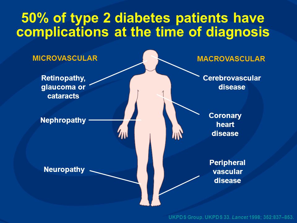 50% of type 2 diabetes patients have complications at the time of diagnosis