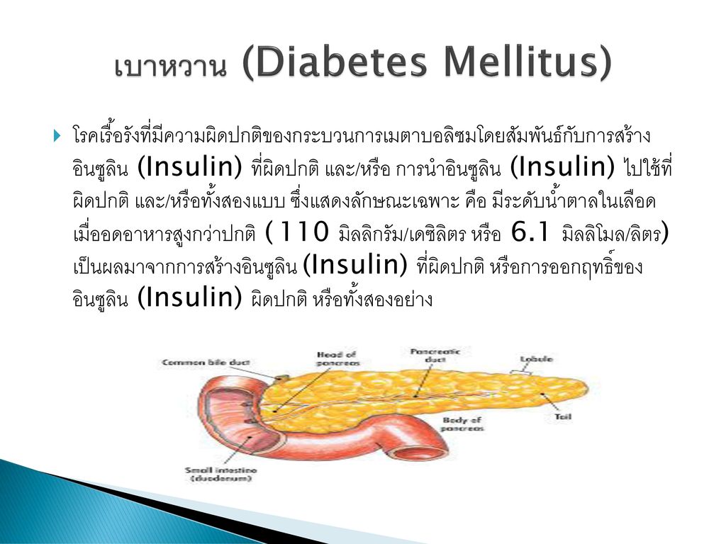 เบาหวาน (Diabetes Mellitus)