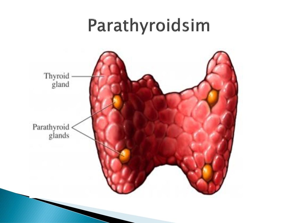 Parathyroidsim