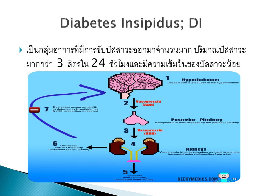 Diabetes Insipidus; DI