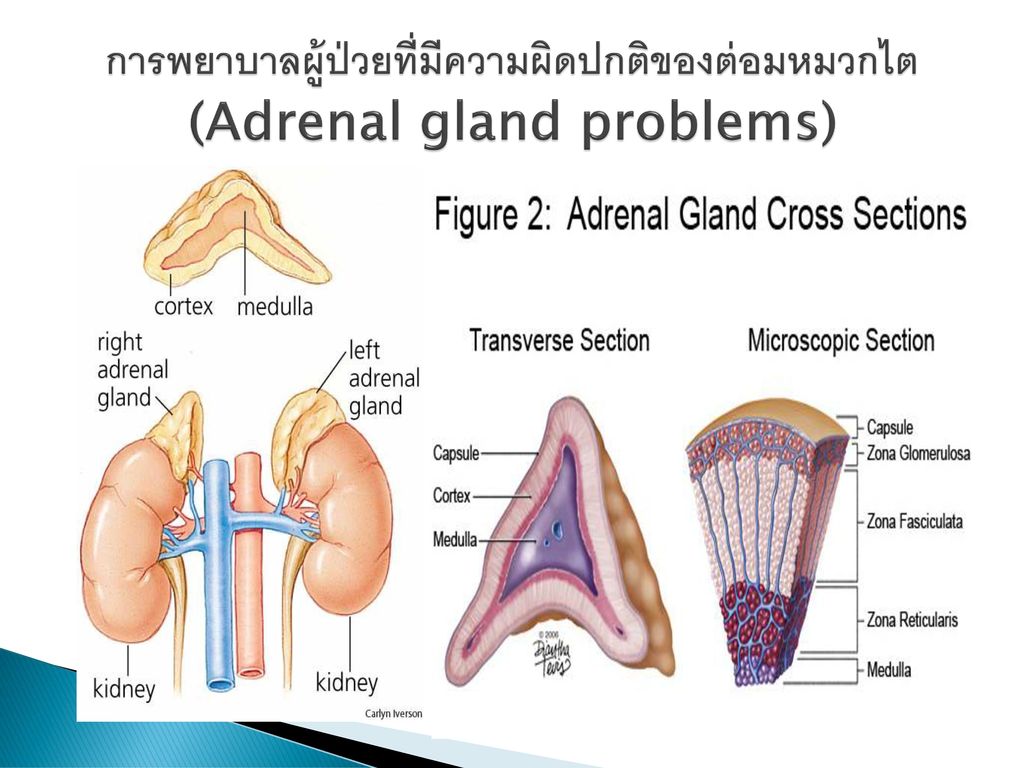 การพยาบาลผู้ป่วยที่มีความผิดปกติของต่อมหมวกไต (Adrenal gland problems)